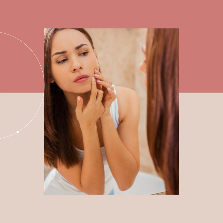 skincate tips for people with acne blackheads and breakouts