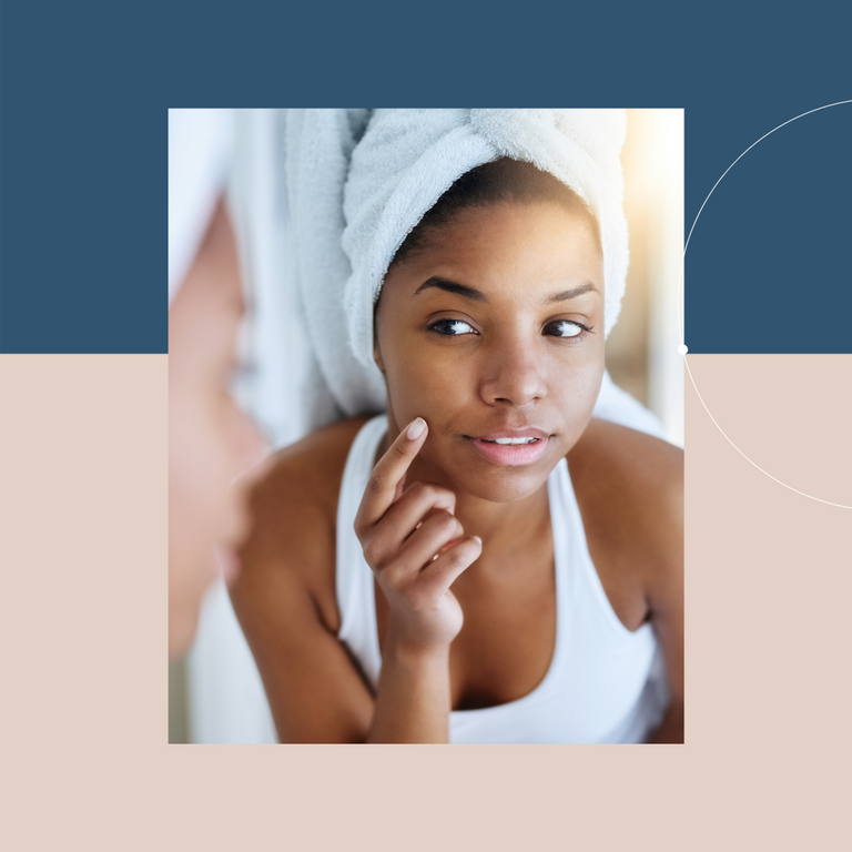 what is melasma hyperpigmentation what is the difference skincare